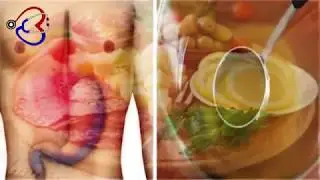 calaamadaha gaaska iyo rashinka u daran dadka gaaska qaba