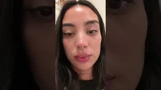 I INJECTED MY LIPS 👄 AND IT WENT WRONG 😩.... well not so bad 😂 Hyaluronic acid in lips