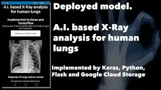 AI project with Flask. Deployed Keras model - Google Cloud. Jupyter Notebook to Web application