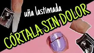 Como cortar mi uña postiza lastimada  de  acrílico sin lastimarme más
