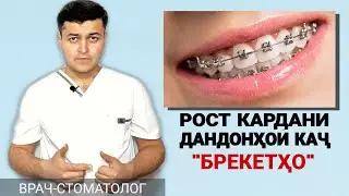 Рост кардани дандонҳои каҷ | Брекетҳои дандон