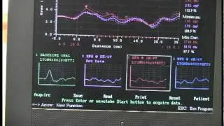 Dental Sleep Med Systems Presents Airway Metrics Part 2