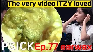 Ep. 77 Earwax removal (Korean ENT doctor “King of earwax”) 귀지형의 Ep.77 귀지제거