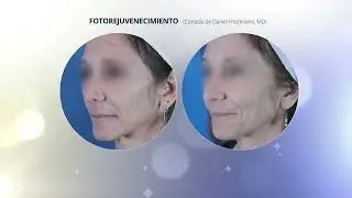 Consulta nuestros tratamientos de rejuvenecimiento.