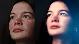 How to remove pimples/acne in your photo using Picsart