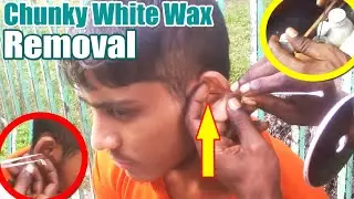 ►Teenager Ear Waxing by an Expert Guys II Nice Way to Get Refreshment at Roadside II Great Job