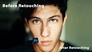 High-End Retouching of Skin / Remove Blemishes & Scars/Photoshop 2020/PKJ Editing