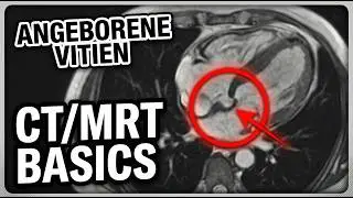 🩷 Herz CT und Herz MRT: Einführung in die Diagnostik angeborener Herzfehler 🚀