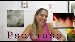 PSORIASE? Dica : o que vc deve comer ,para Melhorar