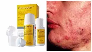 Зинерит - мой опыт применения, результаты, аналоги, отзывы