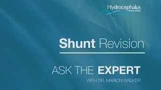 ASK THE EXPERT Episode 2 Shunt Revisions