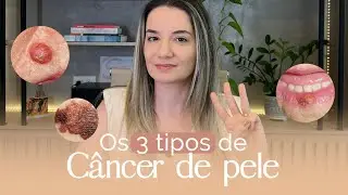 câncer de pele causar metástase? | Dra. Bruna Dal Bello