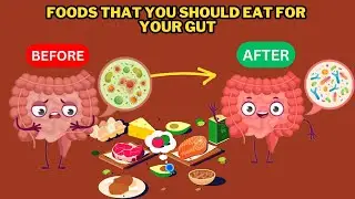 Foods To Improve Gut Health - Gut Healthy Foods - Foods For Gut Health