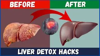 The Best Foods to Cleanse Your Liver
