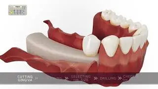 Simple Initial Bone Pen Kit