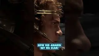 How did Anakin get his scar?
