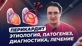 Перикардит  Этиология, патогенез, диагностика, лечение
