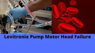Levitronix Pump Motor Head Failure