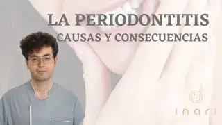 Causas y consecuencias de la periodontitis