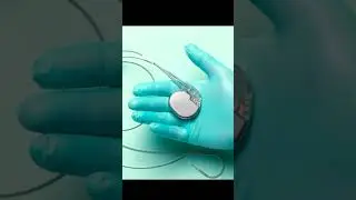 Pacemakers explained,How Pacemaker Implanted 