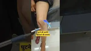 लड़की की घुटने की कटोरी   हमेशा खिसक जाती है | Knee Cap Patellar Dislocation 🔥#patelladislocation