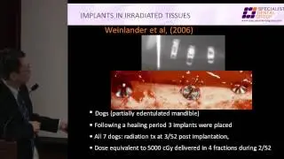 Dental Implants CPG Launch : Radiation Therapy and Dental Implant (2 of 3)