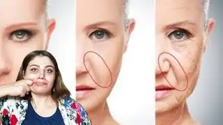 Do you want to get rid of your laugh lines, be with me