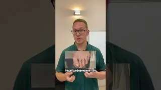 Необратимые последствия ношения тесной обуви #ортопед #обувь #советы