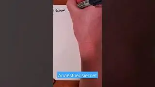 Local anaesthetics in 60 seconds