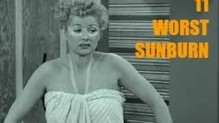 11 FUNNIEST WORST SUNBURNS