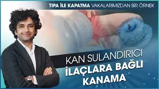 Kan Sulandırıcı İlaçlar, Kanama ve Sol Atriyal Apendiks Kapatma