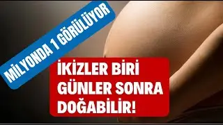 Milyonda 1 görülüyor!