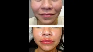 You will NOT believe these results! @sqinmed6152