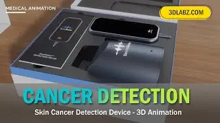Skin Cancer Detection Device | 3D Medical Device Animation | DermaSensor
