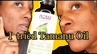 I USED TAMANU OIL FOR A MONTH TO CLEAR MY HYPERPIGMENTATION.