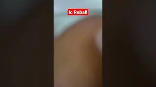 Ic reball #smartphone #shorts