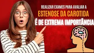Estenose da Carótida | Dr. Humberto Gurgel