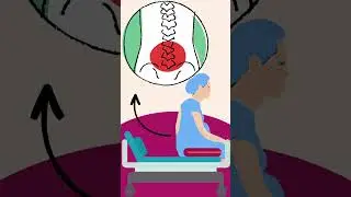 Examining the Epidural #epidural #pregnant #labour #reproduction #anesthetic #women #childbirth