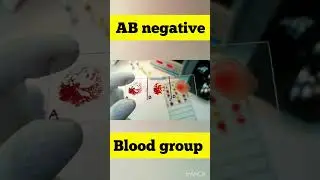 abo blood group | ab negative blood group #shorts #dayinthelife #doctorsvlog #viral #vlog #medical