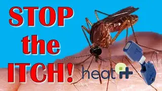Amazing Insect Bite Itch Remover!  Heat-It Product Review