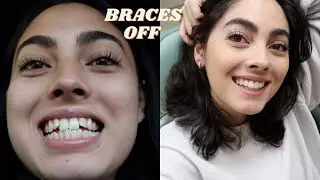 WATCH ME GET MY BRACES OFF VLOG + surprising my family & friends