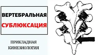 ВЕРТЕБРАЛЬНАЯ СУБЛЮКСАЦИЯ. ФРАГМЕНТ ВЕБИНАРА. ПРИКЛАДНАЯ КИНЕЗИОЛОГИЯ.