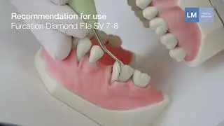 How to use LM™ Furcation Diamond File SV 7-8  hand instrument