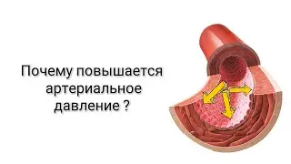 Почему повышается артериальное давление ?