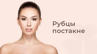 Рубцы постакне
