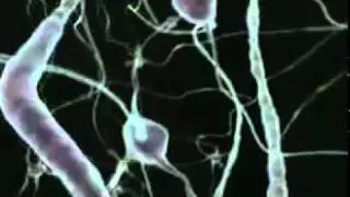 Epilepsia