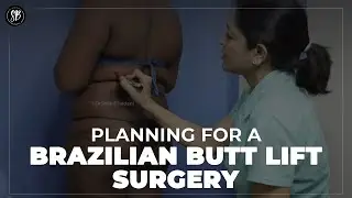 Brazilian Butt Lift Surgery (BBL Surgery) | Butt Lift Surgery in Gurugram | Dr. Shilpi Bhadani