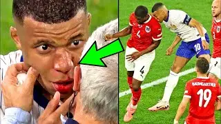 The moment Kylian Mbappé was injured and broke his nose😱, a deadly and dangerous shot !