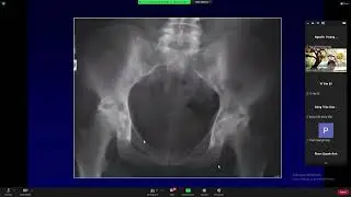 CĐHA Viêm xương khớp -  PGS.TS. BS Bùi Văn Giang