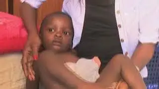 Boy born with imperforate anus - NBC